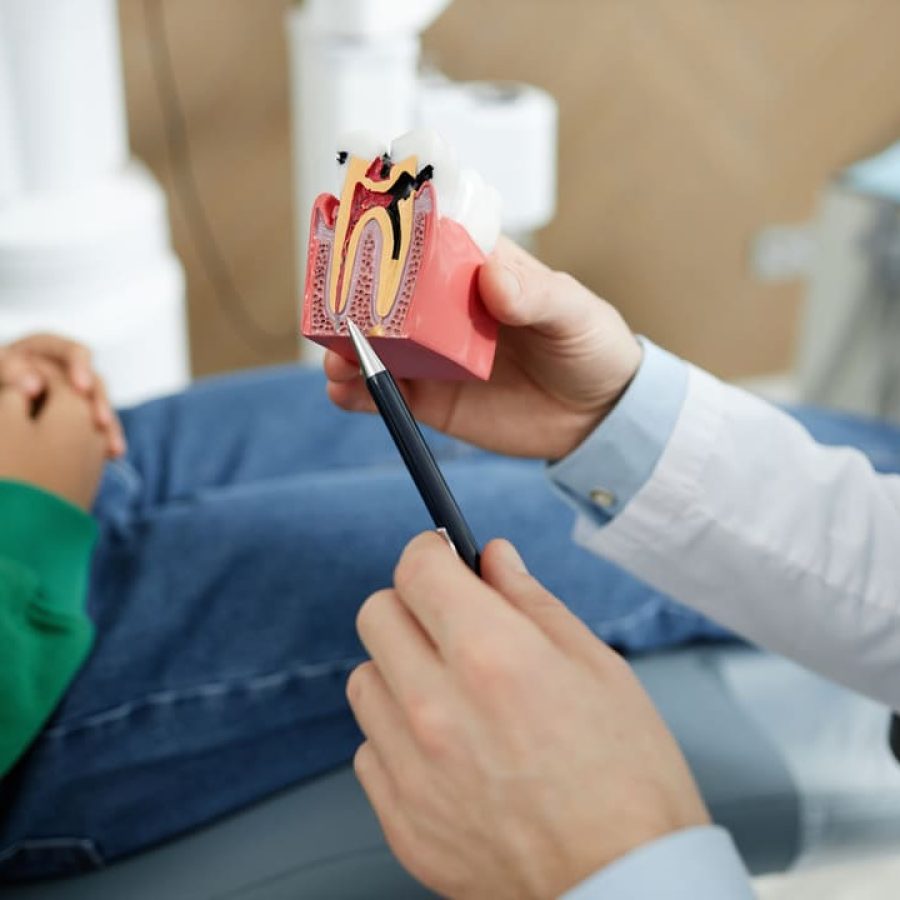 closeup-unrecognizable-dentist-pointing-tooth-model (1)