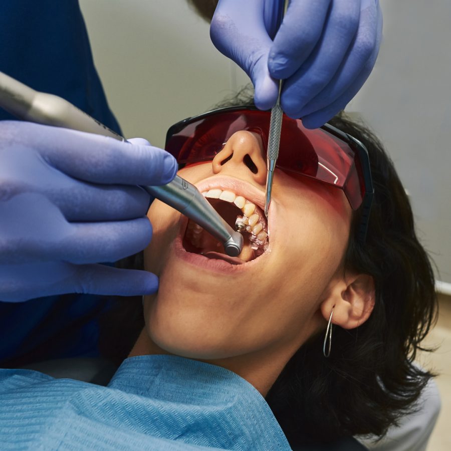 Dentist cleaning a patient's teeth. She is wearing red goggles.