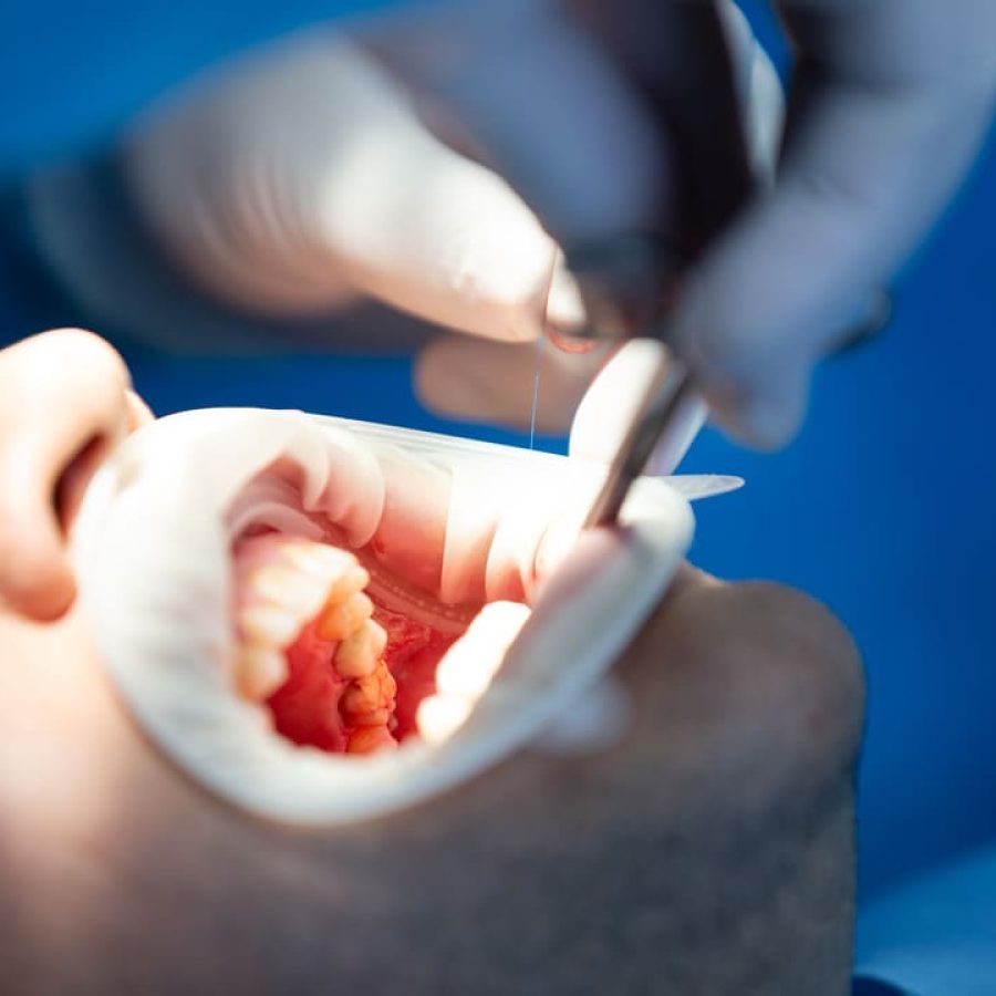 pacient-dental-clinic-while-operation